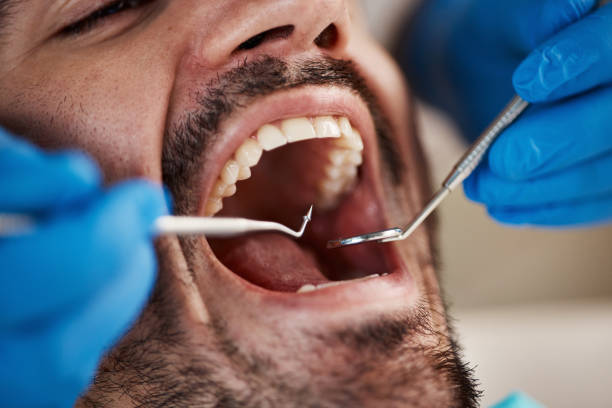 Best Cracked Tooth Emergency Dentist  in Bray, OK