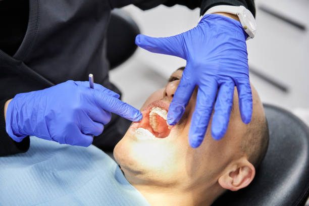 Best Knocked-Out Tooth Emergency  in Bray, OK